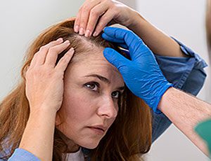 Hair Loss Treatment